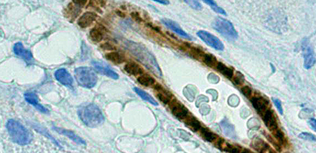 Why RabMAbs aren't the same as any other antibody What's unique about RabMAbs?