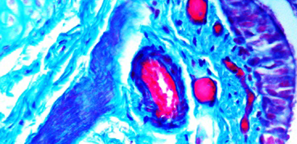 New special stain kits for IHC New special stain kits for IHC