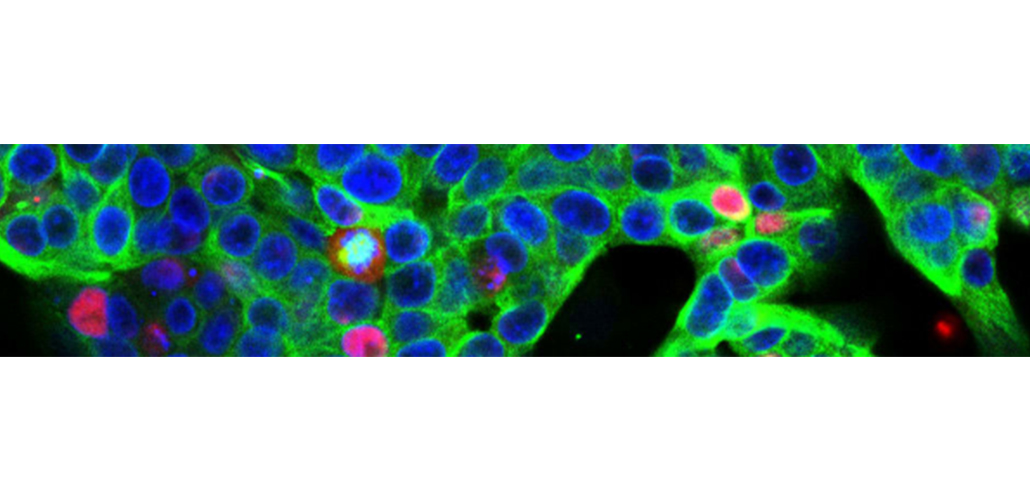 Alexa Fluor® conjugated secondary antibodies from Abcam!